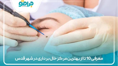 معرفی 10 تا از بهترین مرکز خال برداری در شهر قدس