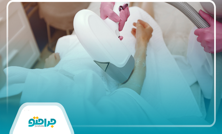 چند جلسه برای لیزر فول بادی نیاز است؟