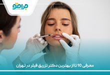 معرفی 10 تا از بهترین دکتر تزریق فیلر در تهران