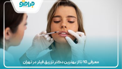 معرفی 10 تا از بهترین دکتر تزریق فیلر در تهران