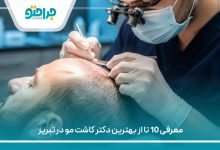 معرفی 10 تا از بهترین دکتر کاشت مو در تبریز