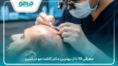 معرفی 10 تا از بهترین دکتر کاشت مو در تبریز