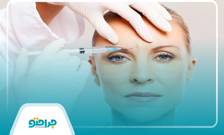 بوتاکس برای کدام قسمت‌های صورت کاربرد دارد؟