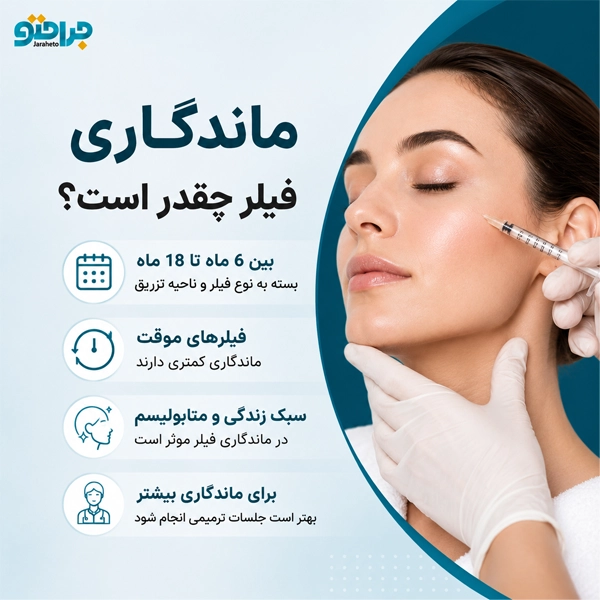ماندگاری فیلر چقدر است؟