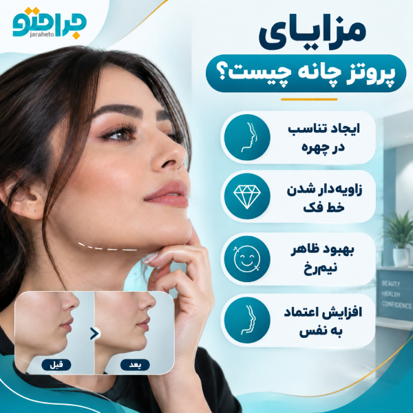 مزایای پروتز چانه چیست؟