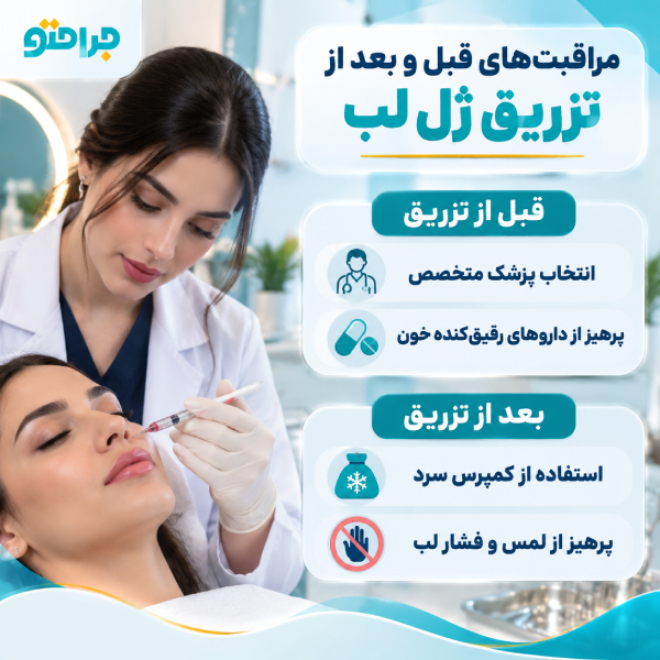 مراقبتهای قبل و بعد از تزریق ژل لب