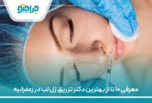 معرفی ۱۰ تا از بهترین دکتر تزریق ژل لب در زعفرانیه